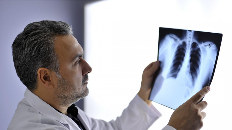 Lékař dívající se na HRCT hrudníku