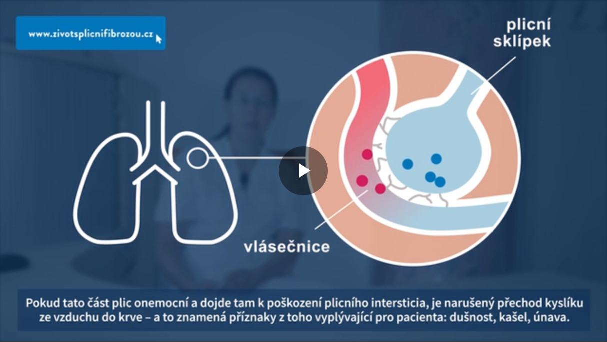 video-co-je-to-plicni-fibroza