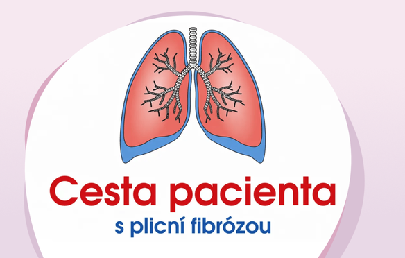 banner-lwpf